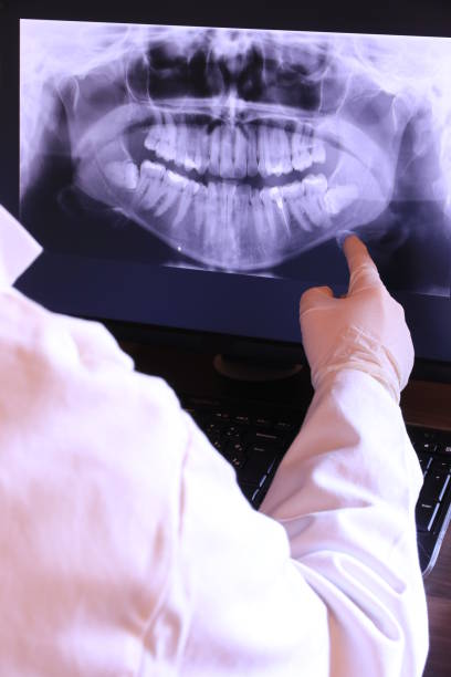 Best Emergency Treatment for Dental Infections or Abscesses in Gahanna, OH