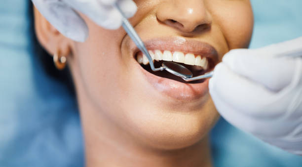 Best Cosmetic Emergency Dentistry in Gahanna, OH