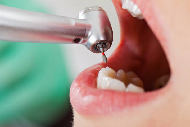Best Weekend Emergency Dentist in Gahanna, OH